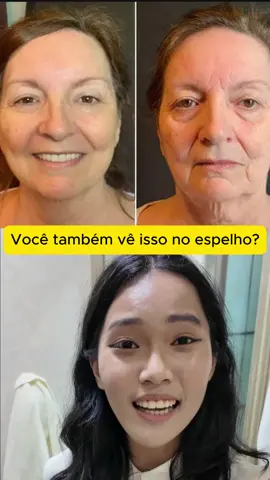 O site do tratamento está aqui na biografia! #envelhecimento #pelesaudavel #terceiraidade #dicasdebeleza #envelhecimentosaudavel #retinol #skincare #rugas
