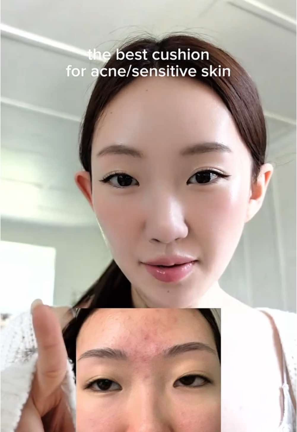 Not sponsored- The best cushion foundation for people with sensitive skin!!! It has never broken me out or flaked throughout the day!! 💗  @Parnell Global @Parnell US  #koreancushion #acneproneskin #sensitiveskin #makeupforacne #kbeautyrecs #cushionfoundation 
