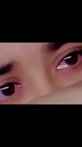 :نقصان پوچھتے ہو میرا چلو بات میری آنکھوں کے نیچے سیاہ حلقوں سے شروع کرتے ہیں 🥺