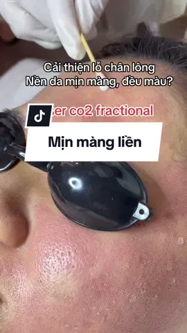 Đẹp vội, đẹp vội 😁😁😁  Nói về bề mặt thì khó công nghệ nào qua 2 em này #jangmiclinic #xhhhhhhhhhhhhhhhhhhhhhhh #xuhuong #skincare #lasertreatment #peel 