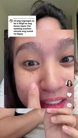 Replying to @jedaaton NATURE’S MIRACLE KASOY CREAM ANG SCARLESS MIRACLE CREAM #naturesmiracle #naturesmiraclekasoycream #naturesmiraclescarlessmiraclecream 