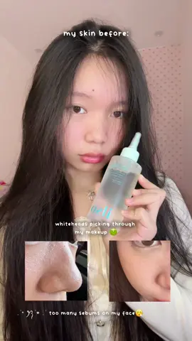 wonyoungism glow up day 1 | i’m using the ilso super melting sebum softener @ilso_official @ilso US  as a girl with a very large pores so my whiteheads easily comes back this is my holy grail🙂‍↕️🩷 in just 15minutes my skin looks glowy and doesn’t feel heavy and greasy anymore! ❤︎₊ ⊹ #ilso #ilsosebum #ilsomeltingsebumsoftener #sebum #sebumremoval #ilso #ilsokorea #kbeauty #kbeautyskincare #kbeautytok #koreanskincare #honestreview #honestreviewskincare #koreanskincareproducts #wonyoungism #wonyoungismglowup #wonyoungismaccount #wonyoungismroutine #wonyoungismfyp 