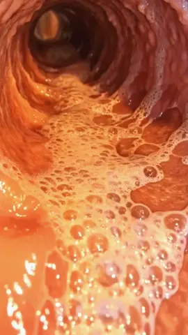 #tiktokshop #TikTok #Clear #FYP #For #body #healthy #Digestive #HealthyHabits #WellnessTips #foryoupage 