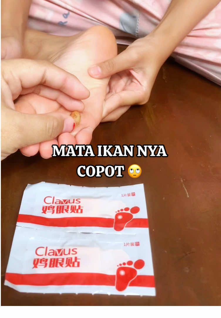 “Kalau kamu juga punya mata ikan yang ngeselin, fix wajib coba ini! Aku sampe bilang, wahhh… mata ikannya copot 😭✨” #r#reviewP#PlesterMataIkanP#PlesterKutilP#PlesterKutilViralP#PenghilangMataIkanO#ObatMataIkanO#ObatKutilM#MataIkanHilaaaangK#KutilMinggatP#PlesterPenghilangKutilP#PlesterPenghilangMataIkanO#ObatKutilAmpuhO#ObatMataIkanAmpuhM#MataIkanSembuhP#PlesterViralO#ObatKutilViralK#KutilHilaaaangS#SolusiKutilS#SolusiMataIkanK#KakiBebasMataIkanK#KulitBersihTanpaKutil#f#fypシm#masukberandafypk#kutilP#PlesterMataIkanP#PlesterKutilP#PlesterKutilViralP#PenghilangMataIkanO#ObatMataIkanO#ObatKutilM#MataIkanHilaaaangK#KutilMinggatP#PlesterPenghilangKutilP#PlesterPenghilangMataIkanO#ObatKutilAmpuhO#ObatMataIkanAmpuhM#MataIkanSembuhP#PlesterViralO#ObatKutilViralK#KutilHilaaaangS#SolusiKutilS#SolusiMataIkanK#KakiBebasMataIkanK#KulitBersihTanpaKutilR#ReviewPemakaianP#PlesterPillarV#VaporArterC#CeritaKulitkuP#ProdukViralR#ReviewJujurB#BarangViralM#MurahBerkualitasViralTikTokclavus 