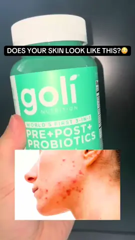 Grab these healthy gut gummies and add them to your daily routine! They are super cheap in the shop right now!  #tiktokmademebuyit #viral #influencer #phone #tiktokmademedoit #essential #healthy 
