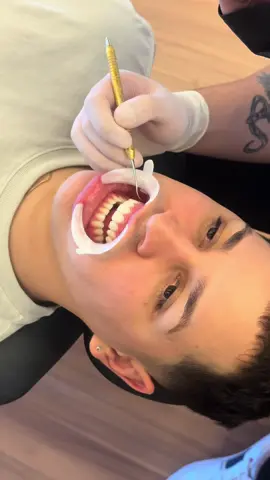 DIA DE REALIZAR MAIS UM SONHO COM UM DOS MELHORES DENTISTA @dr.eduardotretin ♥️🦷 #viral #pow_mark #tiktok #foryou #pravoce #fy 