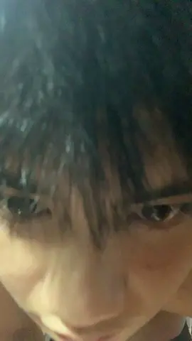 Dị ứng r