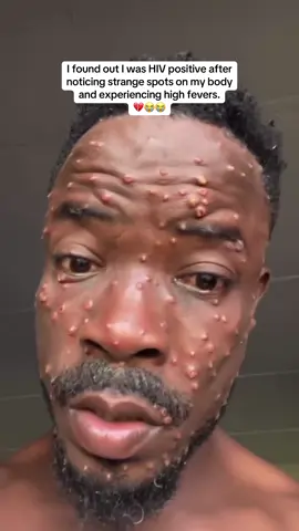 😭💔 #couple #hospital #women #men #HIV #cancer 