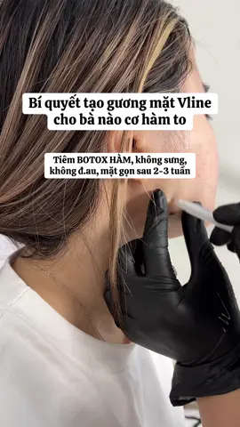 Bà nào muốn mặt vline chỉ 1🍠5 .Botox thon gọn hàm mạnh #Macademy #mayspa #botox_gọn_hàm #filler_botox_uy_tín 