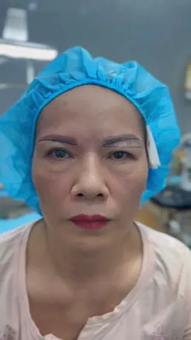 Nâng cung mày 