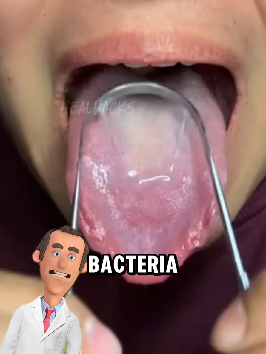 Bakit amoy panis pa rin kahit bagong toothbrush? #oralcare #freshbreath #tonguescraper #dentalhygiene #healthhack #badbreathsolution #yellowbasketfinds #tiktokfinds #CleanTok #oralroutine #dailyhealthtips #hygienetips #dilalinis #mouthcare   #fyp #Science #facts #biology 