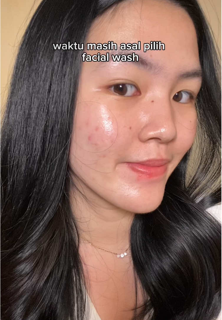 kalo kulit kalian lagi #jerawatan wajib banget cobain facial wash yang mengandung cantella 🙂‍↕️🧴 #acnecleanser #acnefacewash #acnetreatment #fyp #acneskincare #skincare #facewash #facialwash #acne #jerawathilang 