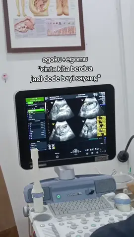 #pregnancy #bumil #fypp