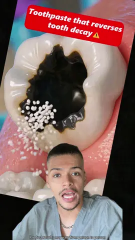 Hydroxyapatite has long been the gold standard in dental care#usa #usa🇺🇸 #teeth #oral #ghviralvideo #braces #viralvideo #health #story #dentist #knowledge #pov #fyp #cavities #cavity #oralhealth #TikTokshop#tooth#toothpaste#workout#fouyou#fyp#tiktokmademebuyit#TikTokshop#teethwhitening#ceelike#tiktokshopcreatorpicks#tiktokshoprestock#ShopVideoCarnivall#Outdoorfun#ceelike #oralhealth #toothpastetablet #toothpaste #Hydroxyapatitetoothpaste #Dentalcaries #Fixedteeth #Dentalcare #teeth #tooth #Gingivitis #Oralbacteria #DentalHealth #tiktokshopholidayhaul#FallDealsForYou#tiktokshopblackfriday#Springglowup#Springtok#videowave