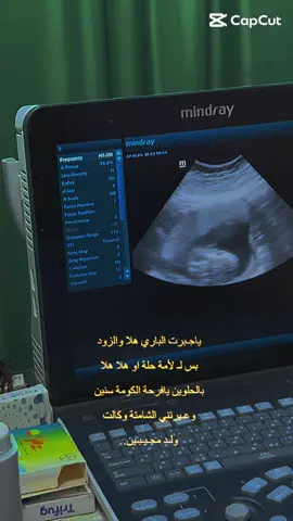 عيرتني الشامتة وكالت ولد مجيبين 😻🧿