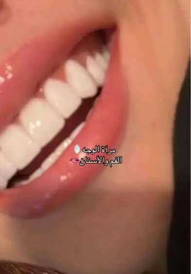 #foryoupage #fyp #GlowUp #algeriangirl #cleangirl #teethcare #mouthwash #dentist #glowup #summerglowup #summervibes #الشعب_الصيني_ماله_حل😂😂🙋🏻‍♂️ #girlsgirl #beautytips #girlssupportgirls #healthygirl 