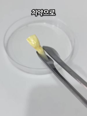 누렁니가 정말 하얘지는지 직접 테스트해봤습니다