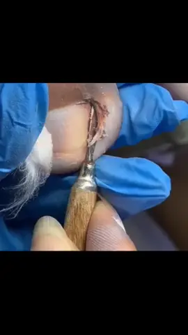 nails #nails #asmrvideo #asmrvideo #nails #satisfaction #asmrtiktoks #satysfing #nail #fyp #asmr #nailsalon #foryo #faryoupage #pageforyou 