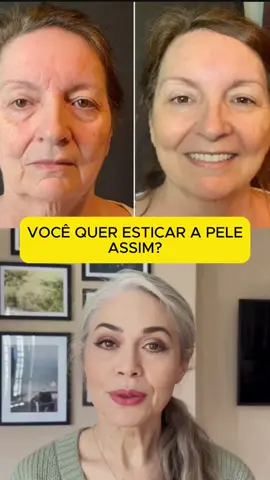 O site do tratamento está aqui na biografia!  #PróstataAumentada #DificuldadeUrinar #TratamentoNatural #hiperplasia #prostatasaudavel #PróstataInflamada #HiperplasiaProstática #prostata