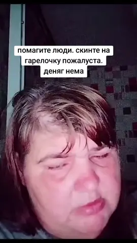 выживаю. як могу #натальясуббот #натальяжитковичи 