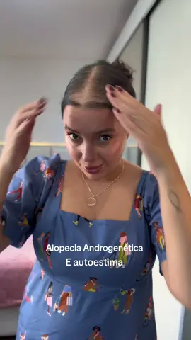 Make capilar com segurança: @Super Billion Brasil não causa queda e não entope os folículos! E o resultado? Autoestima lá em cima! 💗 #MakeCapilar #billionhair #alopecia #alopeciaandrogenetica #calviciefeminina #quedadecabelo #desfarce #cabelo #euemeucabelo #danisalvador #niteroirj #niteroi #dicadeamiga 