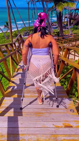 35 anos… e sobrevivi a dias que achei que não suportaria. Isso é vitória!#amputada #foryou #viral_video #fy #foryoupag #fypagechallenge #foryoupag #fypシ゚viral🖤tiktok☆♡🦋myvideo #vencendoocancercomalegria 