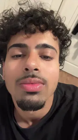 Chat do whitening strips work