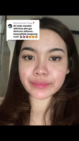 Membalas @𝓜𝓮𝔂𝔂❣ #ConSantanderConecto nih honest review pemakaian 1th dari aku guys. Jangan takut buat cobain skincare paketan ya selain kulit kita jadi lebih keliatan sehat juga ga merah” kl kena panas, secinta itu sama @Adleeva 