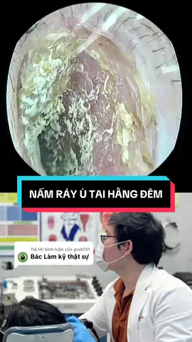 Trả lời @grab721 Bs cố gắng làm sạch nhất có thể cho bệnh nhân mau khỏi | Phòng khám Tai Mũi Họng Việt Đức Quận 12, Hóc Môn, Củ Chi, Tân Bình, Gò Vấp #bsductmh #layraytainoisoi #phongkhamtaimuihong #earwaxremoval #xuhuongtiktok 