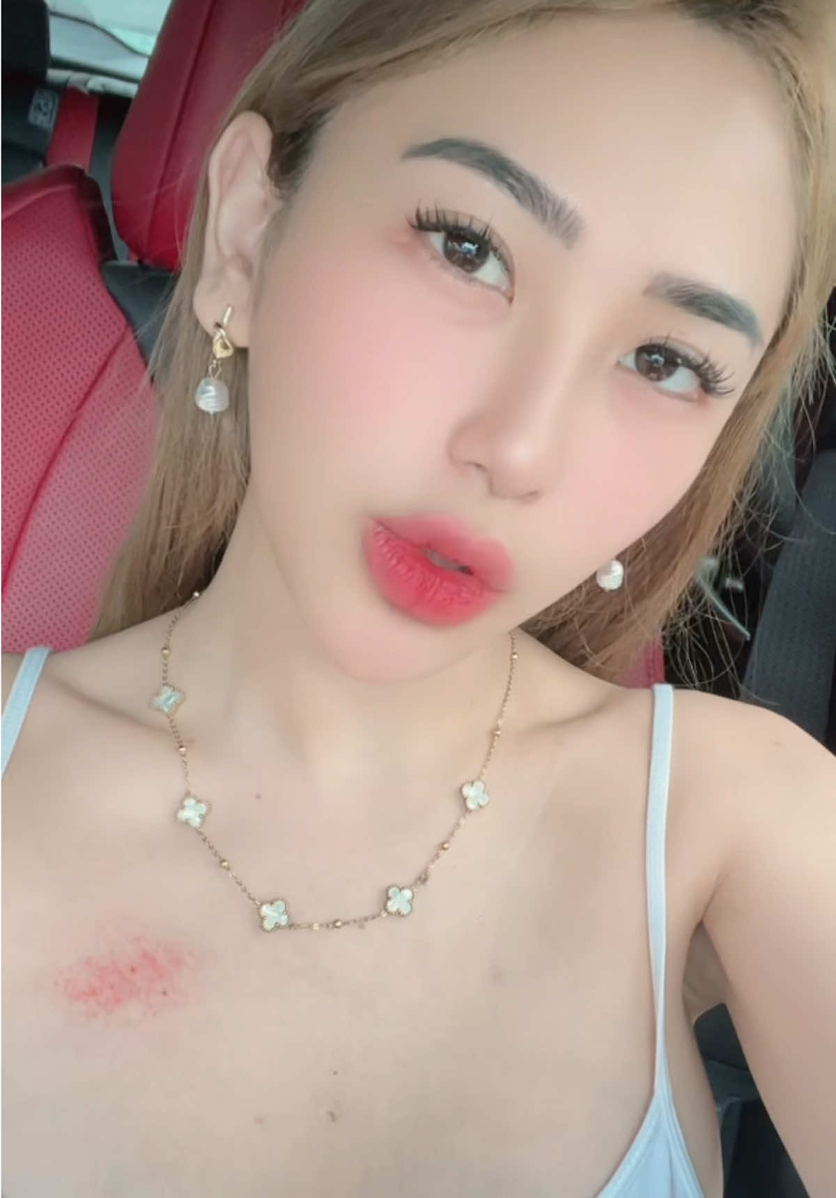 Allergy po yan ha! 😌 #fyp #allergy 