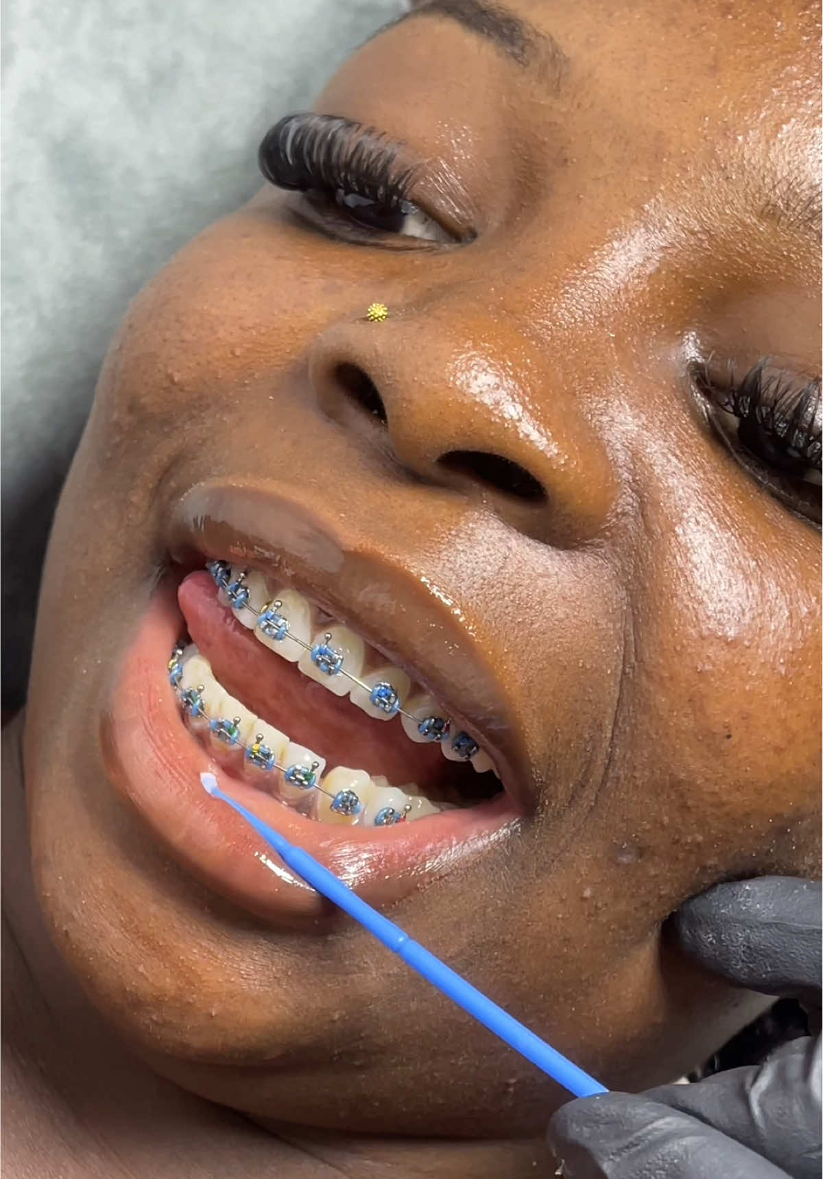 From basic to brace face baddie 💅✨ No pain, no pressure  just pure aesthetics! Book your fashion braces now 💎 Train with me online or physically DM to start! #zinnysbeautystudio #surulerebeautystudio  #FashionBraces #BraceFaceGlow #ToothGems #LagosBeautyPlug #BeautyHustle #fashionbracesnigeria #fashionbracesinsurulere #howtoinstallfashionbrace #fadhionbracesinstallation #TeethTransformation #TikTokBeautyNG #BookNow”