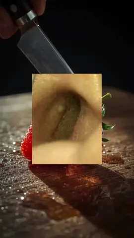 Pimple cleaning #relaxing #cystpopping #cyst #USblackhead #blackhead #asmr 