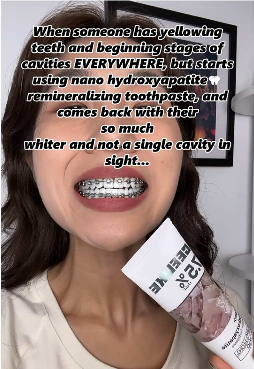 If you don't pay attention to black spots on your teeth，This video can help you.#nanohydroxyapatite #toothpasteforcavities #cavitytoothpaste#toothpaste #teethcare #Toothdecay #toothpaste #Hydroxyapatitetoothpaste #Dentalcaries #Fixedteeth #Dentalcare #teeth #tooth #Gingivitis #Oralbacteria #DentalHealth #tiktokshopholidayhaul #FallDealsForYou #tiktokshopblackfriday#Springglowup#Sprngtok#one#TikTokShop#tooth#toothpaste#workout#fouyou#fyp#tiktokmademebuyit#TikTokshop#teethwhitening#TikTokshop#ShopVideoCarnivall#Outdoorfun#videowave 