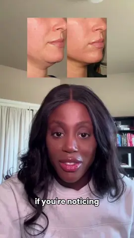 Facial puffiness? Bra strap marks? New stretch marks? It’s not always weight gain — it could be sluggish lymph #lymphatichealth #facialpuffiness #stretchmarks #couchindentation #cellularhealth #detoxsupport #functionalmedicine #tiktokwellness #healthtok 