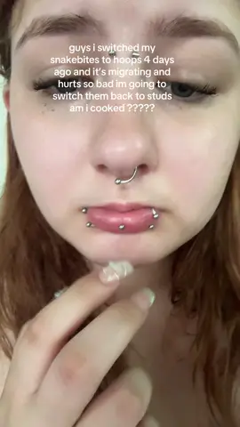 they hurt so bad rn 
