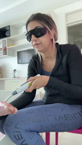 Fazendo laser em Eloah no pé  ##epidermolisebolhosadistroficarecessiva##eloahdearaujo10