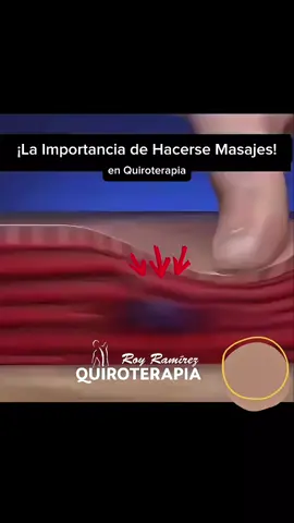 Así actúa un masaje terapéutico en tus músculos 🔥 Mirá cómo, con técnicas de liberación miofascial y pasadas digitales, las contracturas van desapareciendo. Esto ayuda a: ✅ Reducir el dolor y la rigidez ✅ Mejorar la circulación sanguínea ✅ Aumentar la flexibilidad y movilidad ✅ Disminuir el estrés y la tensión muscular Si sentís molestias o tensión acumulada, agendá tu sesión y devolvéle a tu cuerpo el bienestar que necesita. 💆‍♂️💙 #masajes #musculos #bienestar #reels #salud #cuerpo #quiroterapia #quiroterapiaroyramirez 
