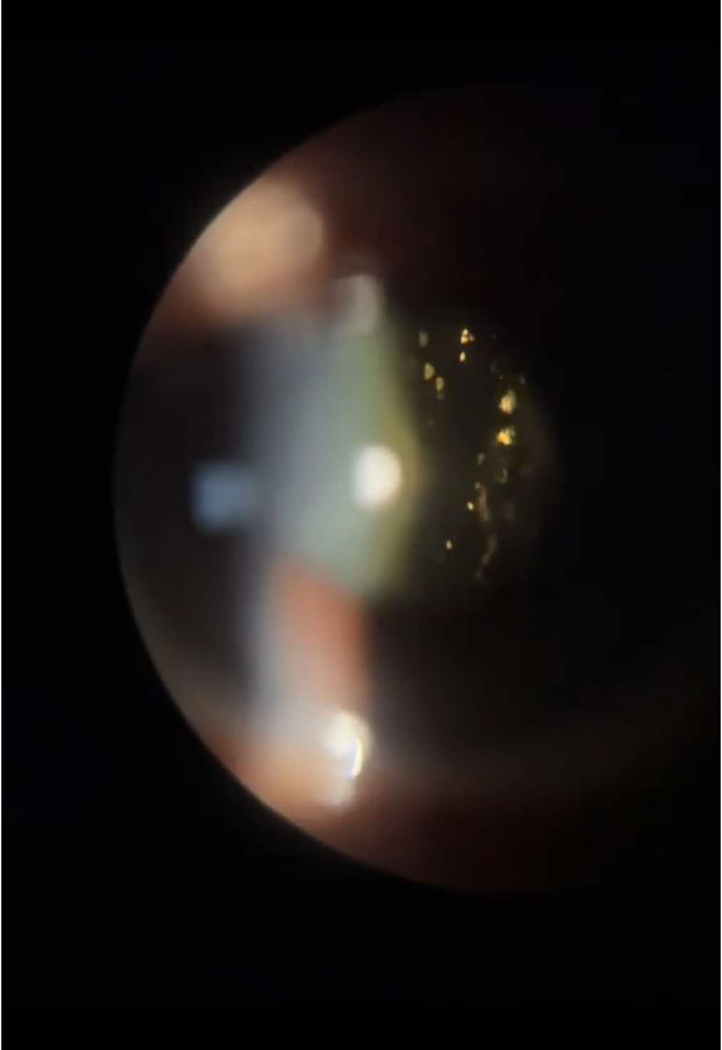 Always fun to see some ✨💫 #fyp #Medical #optom #optometrist #fyppp #eyes #عيون #طب #optometry #اكسبلور #explore #optometryschool #ophthalmology #فوريو #reels 