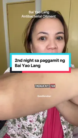 Bai Yao Lang antibacterial Oitment update ni Ma’m B #baiyaolangcream #skinoitmentcream #teacherbeiarecommends #teacherbeiarecommends 
