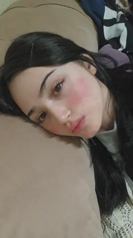 meu rosto vermelho de frio #fy 