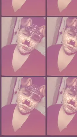 #fypပေါ်ရောက်စမ်း😒👊🏻မရောက်လည်းနေ🥴 မလှမပ့နက်ကွာ🥺🥺💗 