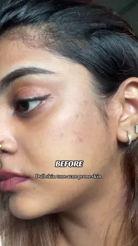 #facebrightrening #glutathione #brightening #cureacne #whitening 