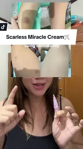 Nature's Miracle Scarless Miracle Cream #naturesmiracle #scarlessmiraclecream #scarsremover #acnemarks #stretchmarkremoval 