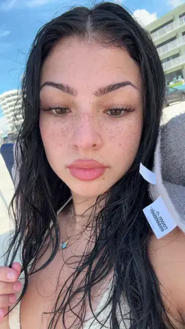 The freckles are freckling