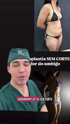 Existe uma abdominoplastia SEM CORTE ao redor do umbigo !!! A união de novas técnicas cirúrgicas e tecnologias que EU TENHO                      modificaram os resultados cirúrgicos💎 Olha esse resultado ! Você quer técnica e tecnologia? Vem comigo !!! Me segue, salva e compartilha esse vídeo com quer técnicas diferenciadas Dr. Marcelo Almeida  Cirurgião Plástico  CRM 2703 -RO   RQE 623 #DrMarceloAlmeida #rondônia