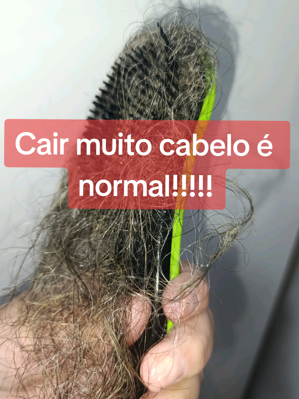 Seu Cabelo Vai Cair Muito . . . . . #quedadecabelo #cabelo #quedacapilar #alopecia #quedadecabelos #muitocabelo #cabelocaindo #cabelocaindo😱😱😱😱😱 