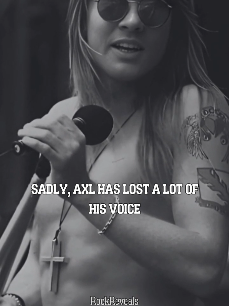 AXL ROSE LOST HIS VOICE!! #gunsnroses #axlrose #slash #rocknroll #80s 