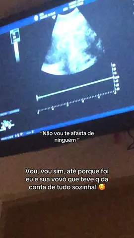 #gravidezcomhumor 