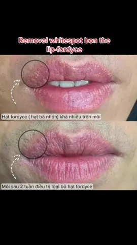 #lazer #sannesns #6deyebrow #zhonglieyebrow #fyp #pinoy #taiwanphilippines🇵🇭🇹🇼 #taiwanindonesia🇹🇼🇮🇩 #eyebrow #zhongli #lipsync #liptatoo #zhongli #zhonglinails #taiwan🇹🇼 #taoyuan #melasma #recommend 