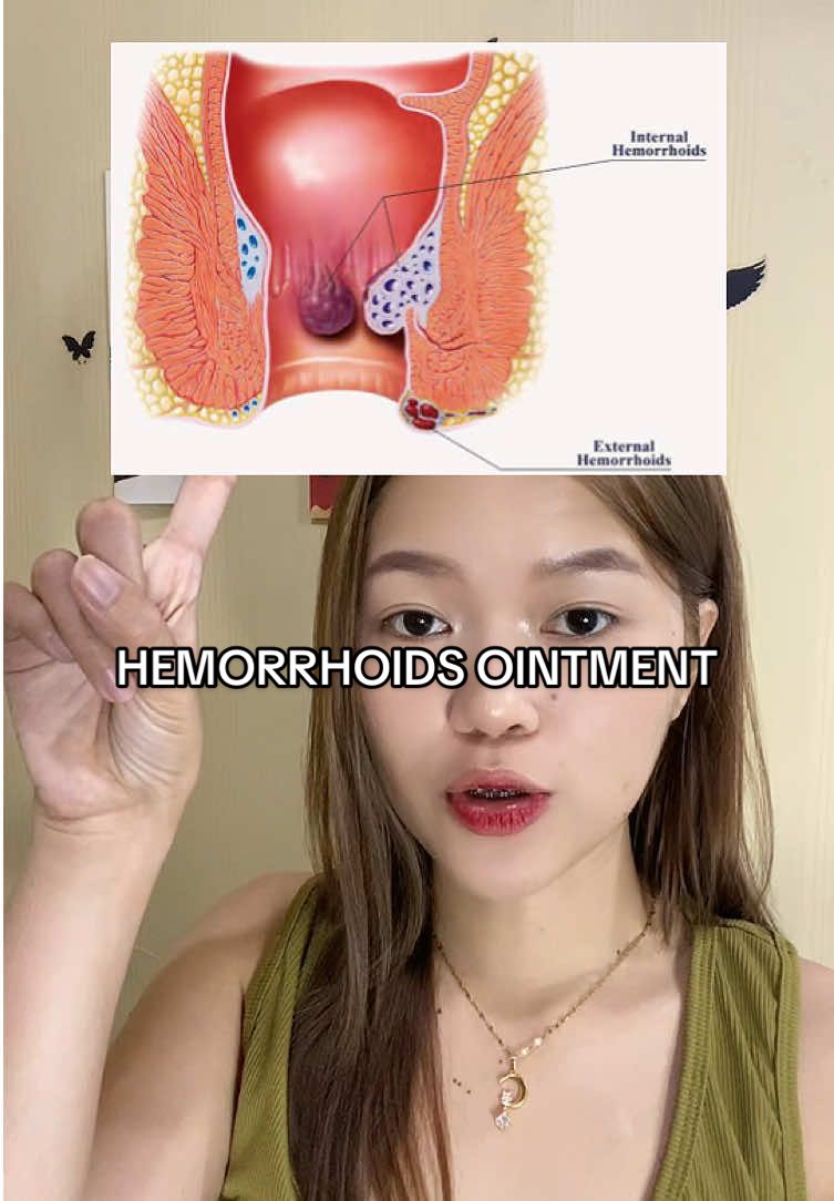 Kung meron ka din hemorrhoids, anal fissures, bleeding sa rectum try mo to baka maka help sayo.  #hemorrhoidsointment #hemorrhoidstreatment #hemorrhoids #fyp 